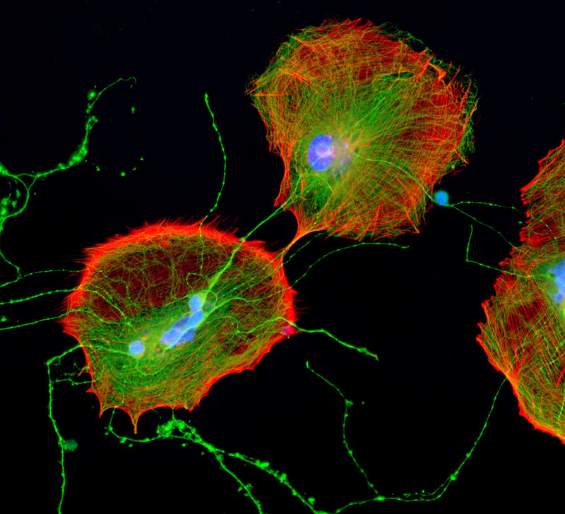 Nervenzellen gefärbt