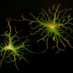 Astrocytes – stellated_Cell Portraits – Jan Schmoranzer