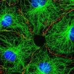 Fibroblasts 1 – Microtubules_Cell Portraits – Jan Schmoranzer