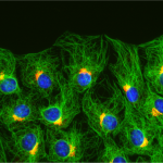 Wound edge fibroblasts with oriented Golgi and Microtubules_Cell Portraits – Jan Schmoranzer