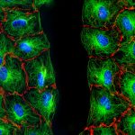 Wounded Fibroblast Monolayer 1_Cell Portraits – Jan Schmoranzer